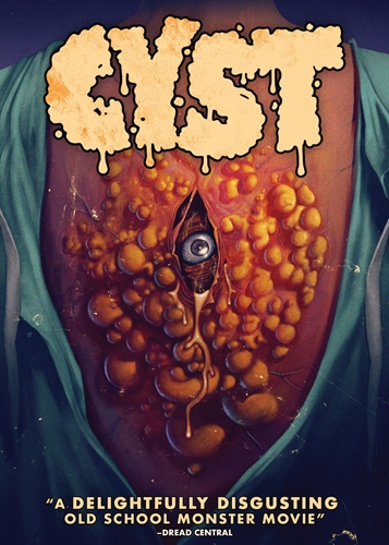 Picture of CYST