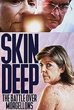 Picture of SKIN DEEP: THE BATTLE OVER MORGELLONS