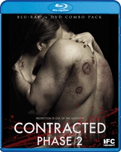 Picture of CONTRACTED: PHASE 2