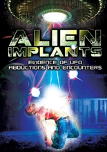 Picture of Alien Implants: Evidence Of UFO Abductions And Encounters