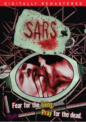 Picture of Sars