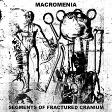 Picture of Segments Of Fractured Cranium