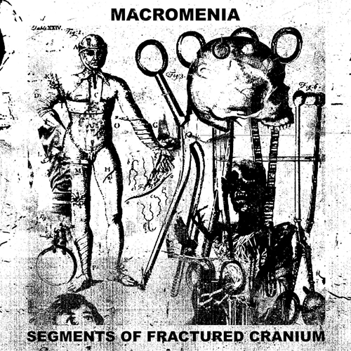 Picture of Segments Of Fractured Cranium